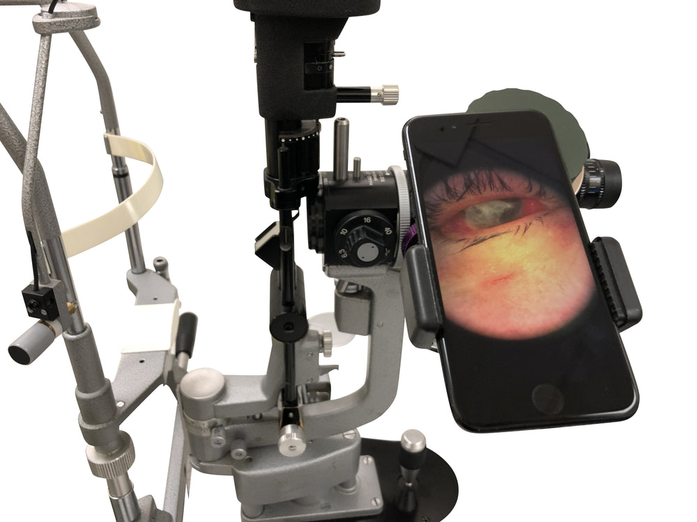 
                  
                    Load image into Gallery viewer, oDocs Slit Lamp &amp;amp; Surgical Microscope Adapter
                  
                