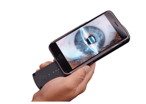 
                  
                    Load image into Gallery viewer, Portable Slit Lamp
                  
                
